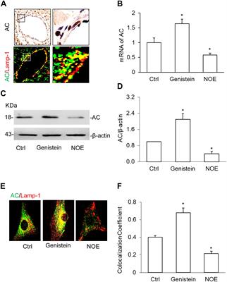 Downregulation of Lysosomal Acid Ceramidase Mediates HMGB1-Induced Migration and Proliferation of Mouse Coronary Arterial Myocytes